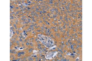 Immunohistochemistry (IHC) image for anti-Biorientation of Chromosomes in Cell Division 1 (BOD1) antibody (ABIN2432731) (BOD1 抗体)