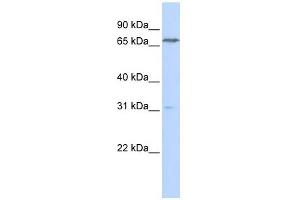 PCCA antibody used at 1 ug/ml to detect target protein. (PCCA 抗体  (N-Term))