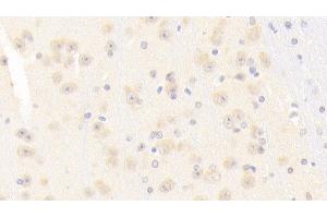 Detection of NOS1 in Mouse Cerebrum Tissue using Polyclonal Antibody to Nitric Oxide Synthase 1, Neuronal (NOS1) (NOS1 抗体  (AA 691-826))