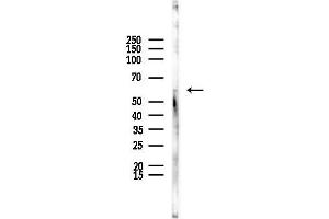 anti-Cholinergic Receptor, Muscarinic 5 (CHRM5) (C-Term) antibody