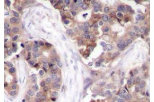 Immunohistochemistry (Paraffin-embedded Sections) (IHC (p)) image for anti-Stathmin 1 (STMN1) (pSer25) antibody (ABIN7265136)