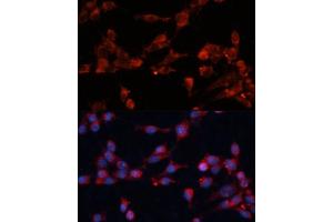 anti-Eukaryotic Translation Initiation Factor 3, Subunit B (EIF3B) (AA 100-350) antibody