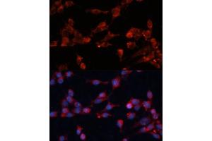 Immunofluorescence analysis of NIH-3T3 cells using eIF3B Polyclonal Antibody (ABIN6130364, ABIN6140053, ABIN6140054 and ABIN6214441) at dilution of 1:100 (40x lens). (EIF3B 抗体  (AA 100-350))