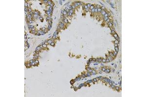 Immunohistochemistry of paraffin-embedded human prostate using EFN Antibody (ABIN6127874, ABIN6139961, ABIN6139962 and ABIN6220974) at dilution of 1:100 (40x lens). (Ephrin A1 抗体  (AA 19-182))