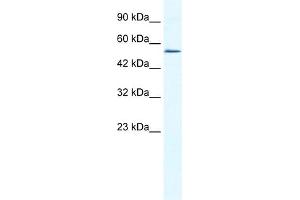 WB Suggested Anti-ZNF286 Antibody Titration:  0. (ZNF286A 抗体  (N-Term))