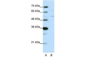 Western Blot showing HNRPK antibody used at a concentration of 1-2 ug/ml to detect its target protein. (HNRNPK 抗体  (N-Term))