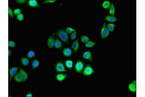 Immunofluorescent analysis of PC-3 cells using ABIN7155150 at dilution of 1:100 and Alexa Fluor 488-congugated AffiniPure Goat Anti-Rabbit IgG(H+L) (Hexokinase 2 抗体  (AA 334-526))