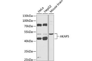 Western blot analysis of extracts of various cell lines, using  Antibody (ABIN6129178, ABIN6136707, ABIN6136709 and ABIN6218330) at 1:1000 dilution. (AKAP5 抗体  (AA 1-270))