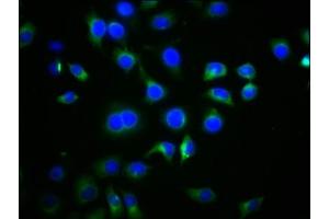 Immunofluorescence staining of A549 cells with ABIN7168752 at 1:77, counter-stained with DAPI. (DVL2 抗体  (AA 1-240))