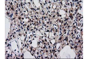 Immunohistochemistry (IHC) image for anti-Bridging Integrator 3 (BIN3) antibody (ABIN1496923) (BIN3 抗体)