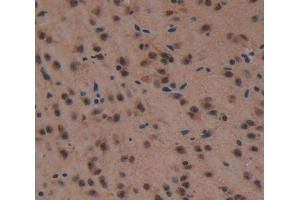 Used in DAB staining on fromalin fixed paraffin- embedded Kidney tissue (HSF4 抗体  (AA 159-411))
