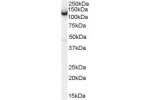Image no. 1 for anti-Amphiphysin (AMPH) (Internal Region) antibody (ABIN374682) (Amphiphysin 抗体  (Internal Region))