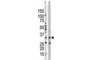 Western Blotting (WB) image for anti-Protein Kinase, AMP-Activated, beta 1 Non-Catalytic Subunit (PRKAB1) antibody (ABIN3002958) (PRKAB1 抗体)