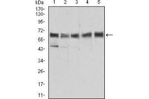 Western blot analysis using ALDH6A1 mouse mAb against Jurkat (1), HEK293 (2), Hela (3), MCF-7 (4), and LNcap (5) cell lysate. (ALDH6A1 抗体  (AA 1-195))