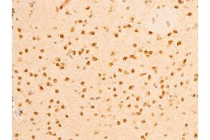 ABIN6267273 at 1/100 staining mouse brain tissue sections by IHC-P.