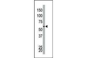 The anti-DYRK4 Pab (ABIN391772 and ABIN2841634) is used in Western blot to detect DYRK4 in Jurkat cell lysate. (DYRK4 抗体  (C-Term))