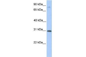 WB Suggested Anti-ABHD13 Antibody Titration:  0. (ABHD13 抗体  (C-Term))