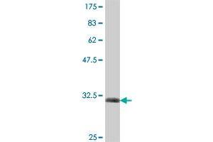 Western Blot detection against Immunogen (32. (SV2B 抗体  (AA 417-476))