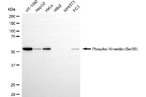 Western blotting analysis using phospho-vimentin (Ser56) antibody (ABIN7800834).