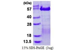 VRK3 Protein (His tag)