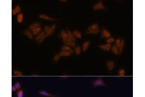 Immunofluorescence (IF) image for anti-Ribosomal Protein S17 (RPS17) antibody (ABIN7259142)