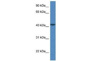 Western Blot showing CAB39L antibody used at a concentration of 1 ug/ml against COLO205 Cell Lysate (CAB39L 抗体  (N-Term))