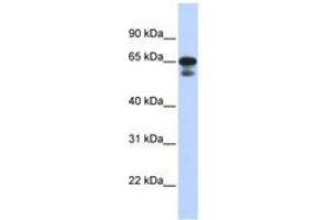 Image no. 1 for anti-Histone H4 Transcription Factor (HINFP) (C-Term) antibody (ABIN6740581) (HINFP 抗体  (C-Term))