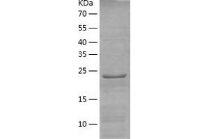Western Blotting (WB) image for RAB34, Member RAS Oncogene Family (RAB34) (AA 1-259) protein (His tag) (ABIN7124750) (RAB34 Protein (AA 1-259) (His tag))
