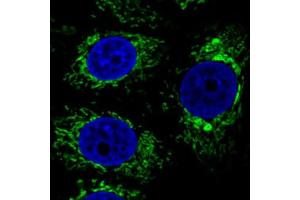 Immunofluorescent staining of MCF7 cells with CS monoclonal antibody, clone CL2545  (Green) shows specific mitochondrial. (CS 抗体)