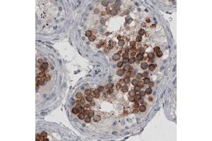 Immunohistochemical staining (Formalin-fixed paraffin-embedded sections) of human testis with LY6K monoclonal antibody, clone CL2433  shows strong cytoplasmic immunoreactivity in a subset of cells in seminiferous tubules. (Ly6k 抗体)