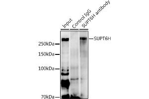 Immunoprecipitation analysis of 600 μg extracts of Mouse heart using 3 μg SUPT6H antibody (ABIN7270645). (Spt6 抗体  (AA 1500-1726))