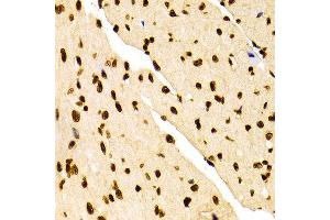 Immunohistochemistry of paraffin-embedded Mouse heart using H3K27me2 antibody at dilution of 1:100 (x400 lens). (Histone 3 抗体  (H3K27me))
