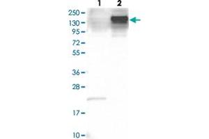 Western blot analysis of Lane 1: Human cell line RT-4 Lane 2: Human cell line U-251MG with ANLN polyclonal antibody  at 1:250-1:500 dilution. (Anillin 抗体)