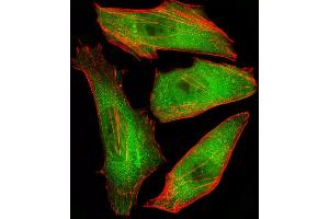 Fluorescent image of Hela cells stained with CFL2 Antibody (C-term) (ABIN6243137 and ABIN6577407). (Cofilin 2 抗体  (C-Term))