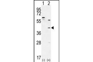 Western blot analysis of TGIF1 (arrow) using rabbit polyclonal TGIF1 Antibody (Center ) (ABIN656000 and ABIN2845379). (TGIF1 抗体  (AA 145-174))