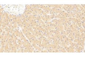 Detection of ST2 in Human Liver Tissue using Polyclonal Antibody to Syntenin 2 (ST2) (SDCBP2 抗体  (AA 1-292))
