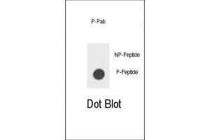 Dot Blot (DB) image for anti-Colony Stimulating Factor 2 Receptor, Beta (CSF2RB) (pTyr766) antibody (ABIN5021357) (CD131 抗体  (pTyr766))