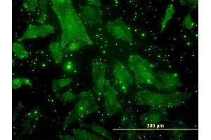 Immunofluorescence of monoclonal antibody to BGLAP on HeLa cell. (Osteocalcin 抗体  (AA 52-100))