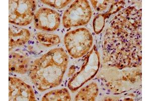 Immunohistochemistry (IHC) image for anti-Proteasome (Prosome, Macropain) Subunit, beta Type 2 (PSMB2) (AA 1-201) antibody (ABIN7164973)
