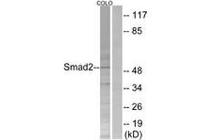 Western blot analysis of extracts from COLO205 cells, treated with serum 20% 15', using Smad2 (Ab-250) Antibody. (SMAD2 抗体  (AA 216-265))