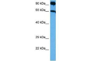 Western Blotting (WB) image for anti-Neurotrophic tyrosine Kinase, Receptor, Type 3 (NTRK3) (C-Term) antibody (ABIN2784511)