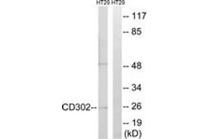 Western blot analysis of extracts from HT-29 cells, using CD302 Antibody. (DCL1 抗体  (AA 51-100))