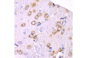 Immunohistochemistry of paraffin-embedded rat brain using RPS3A Antibody (ABIN5973489) at dilution of 1/100 (40x lens). (RPS3A 抗体)