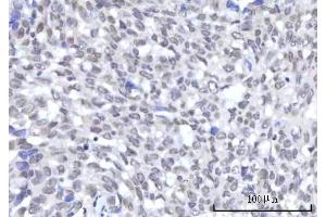 IHC analysis of RBM22 using anti-RBM22 antibody (ABIN7600268).