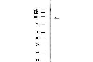 Western blot analysis of lysates from COLO205 cells(heat-shock,45 min treatment), using Phospho-IKK alpha (Thr23) Antibody at 1/1000 dilution.