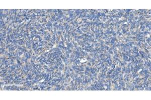IHC analysis of DRP1/DNM1L using anti-DRP1/DNM1L antibody (ABIN7602180). (Dynamin 1-Like 抗体  (AA 618-736))