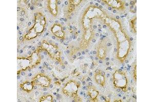 Immunohistochemistry of paraffin-embedded Mouse kidney using FHL1 Polyclonal Antibody at dilution of 1:100 (40x lens). (FHL1 抗体)