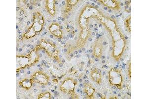 Immunohistochemistry of paraffin-embedded Mouse kidney using FHL1 Polyclonal Antibody at dilution of 1:100 (40x lens).