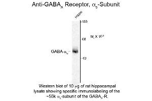 Western Blotting (WB) image for anti-gamma-aminobutyric Acid (GABA) A Receptor, alpha 5 (GABRA5) (Cytoplasmic Loop) antibody (ABIN6658274)
