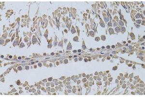 Immunohistochemistry of paraffin-embedded Rat testis using P2RY2 Polyclonal Antibody at dilution of 1:100 (40x lens). (P2RY2 抗体)